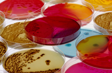 Petri dishes with Bacteria