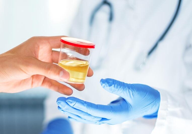 Man handing container with urine sample to a doctor